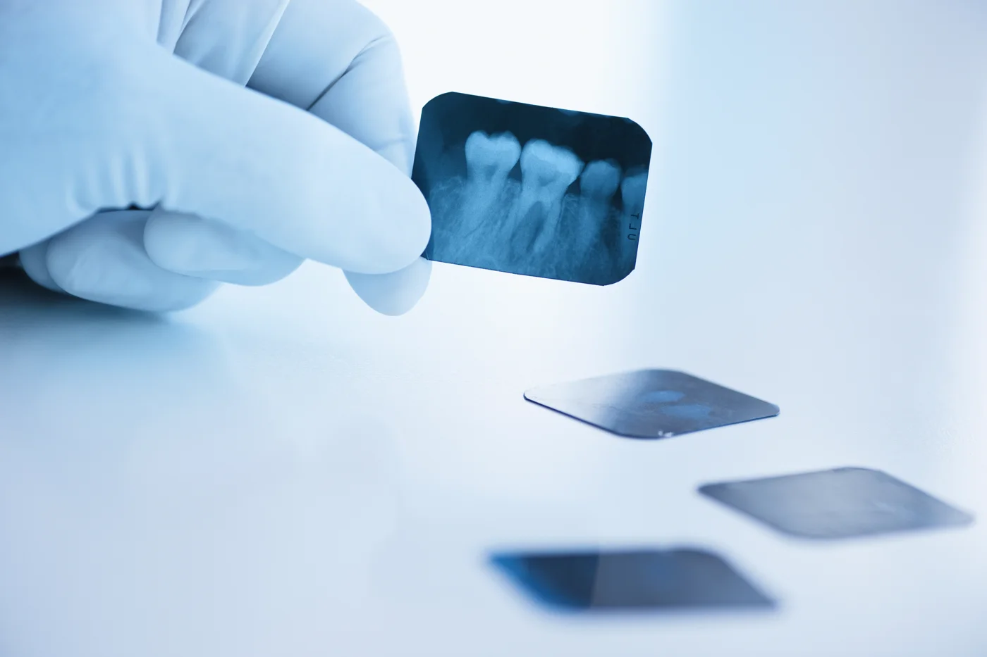 Radiografia dentale, immagine già presente nel sito dello studio